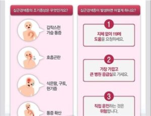 2023_심근경색,증상